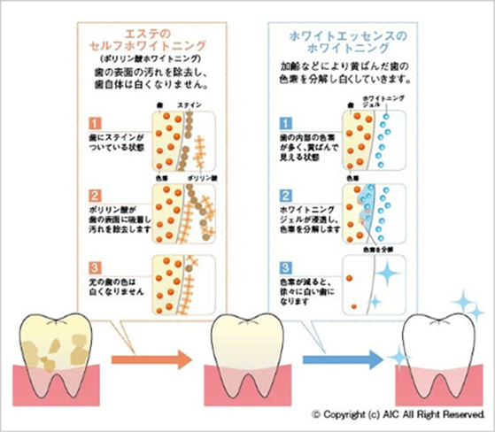 セルフホワイトニングで まったく白くならなかった あなたへ ホワイトエッセンス