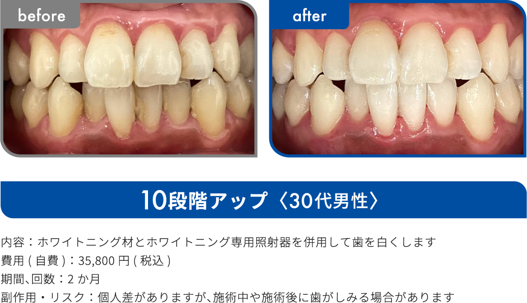 10段階アップ 30代男性