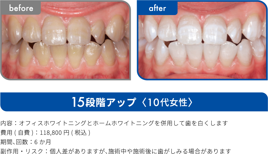 15段階アップ 10代女性