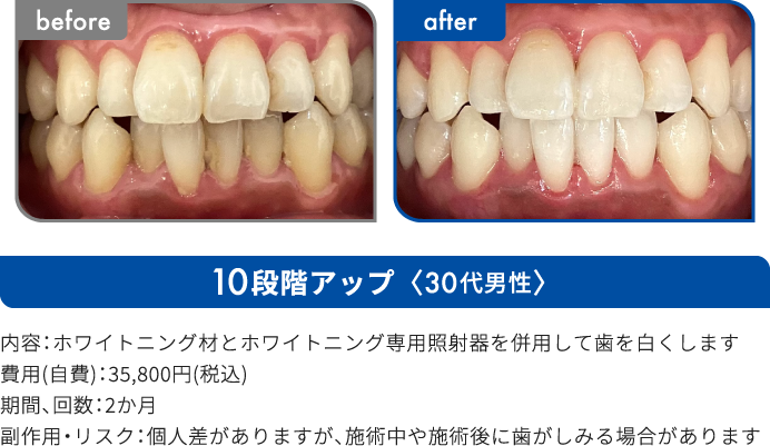 10段階アップ 30代男性