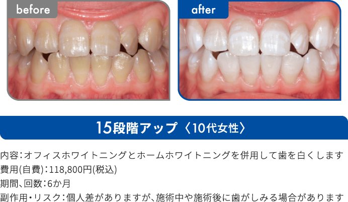 15段階アップ 10代女性