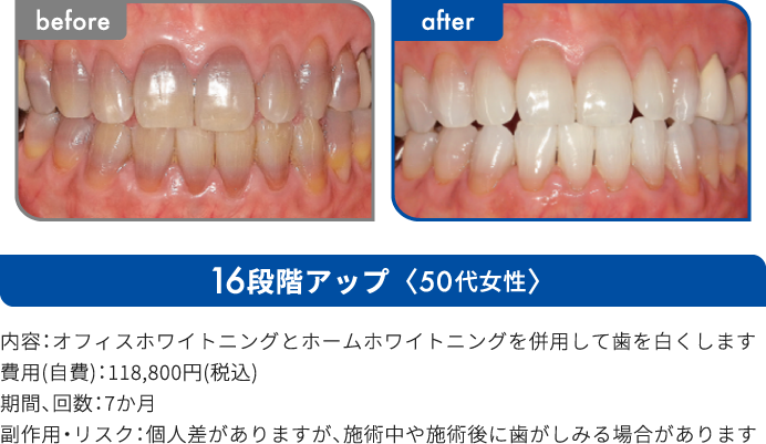 16段階アップ 50代女性