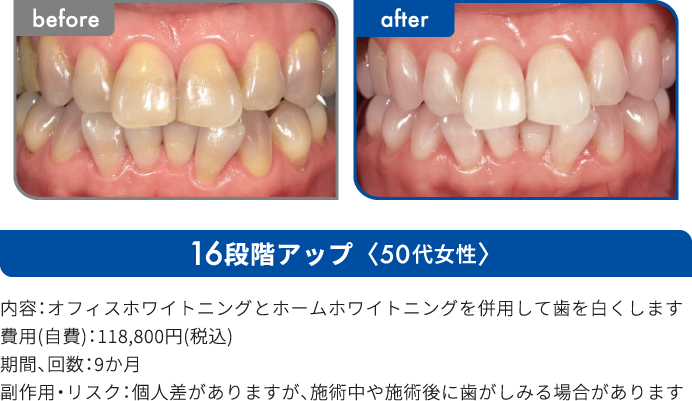 16段階アップ 50代女性