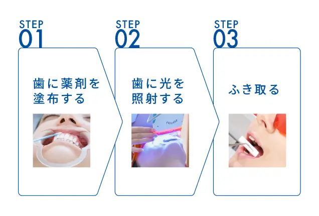 各ステップの施術イメージ