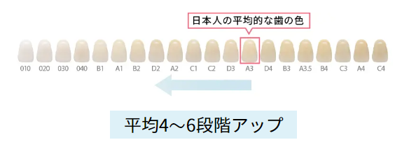 ホワイトニング効果の目安