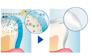 黄ばみの分解イメージ